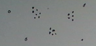 Density-Based And Graph-Based Clustering
